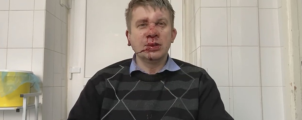 В Запорожье избили депутата облсовета, которому несколько раз громили офис